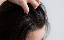 Solusi Praktis untuk Rambut Berminyak dan Lepek