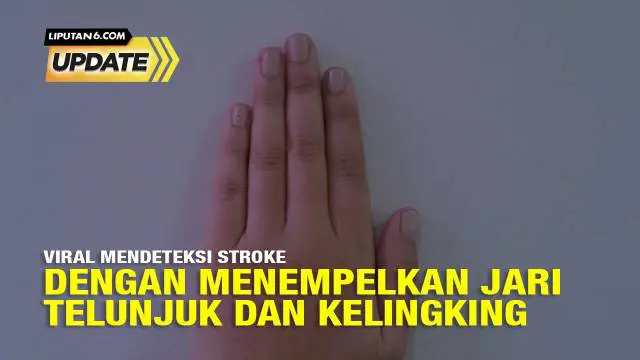 Beredar di media sosial klaim tentang mendeteksi stroke dengan menempelkan jari telunjuk dan kelingking. Klaim tentang cara mendeteksi stroke dengan menempelkan jari telunjuk dan kelingking ternyata tidak benar. Faktanya, kedua hal tersebut tidak ada...