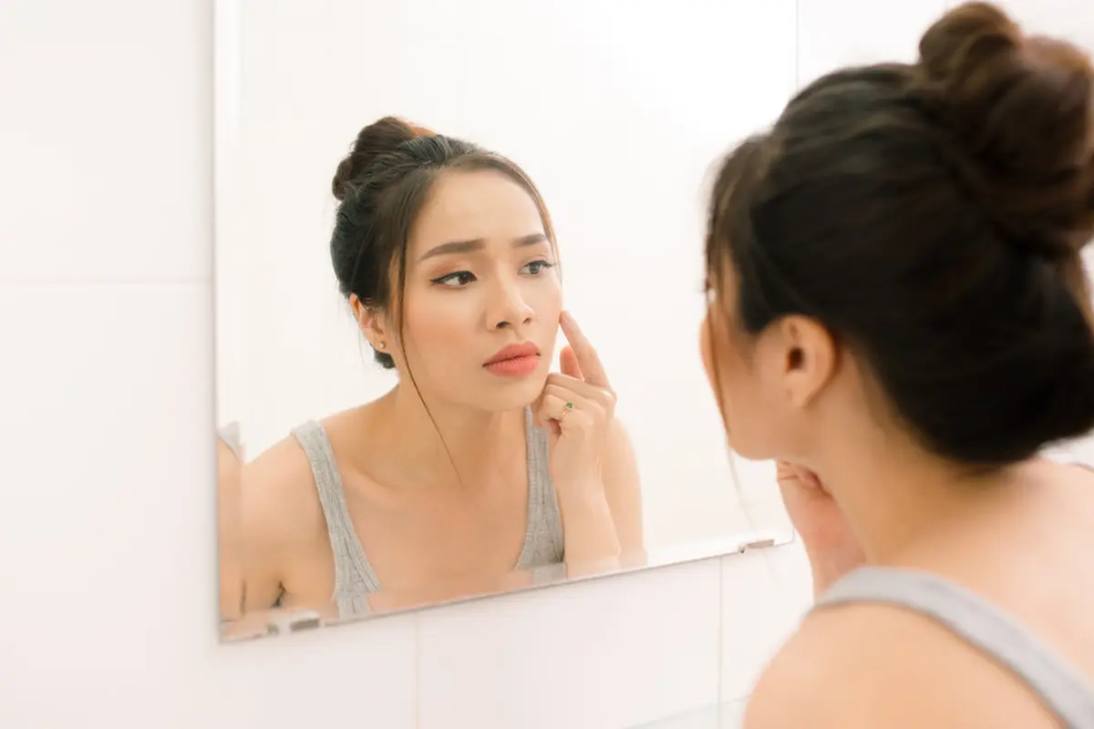 kandungan skincare cocok untuk fungal acne