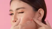 Pakai Pimple Patch tapi Jerawat Tak Sembuh? Ini 5 Kesalahan yang Sering Terjadi