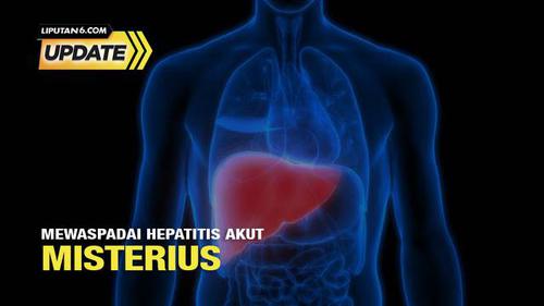 Liputan6 Update: Mewaspadai Hepatitis Akut Misterius