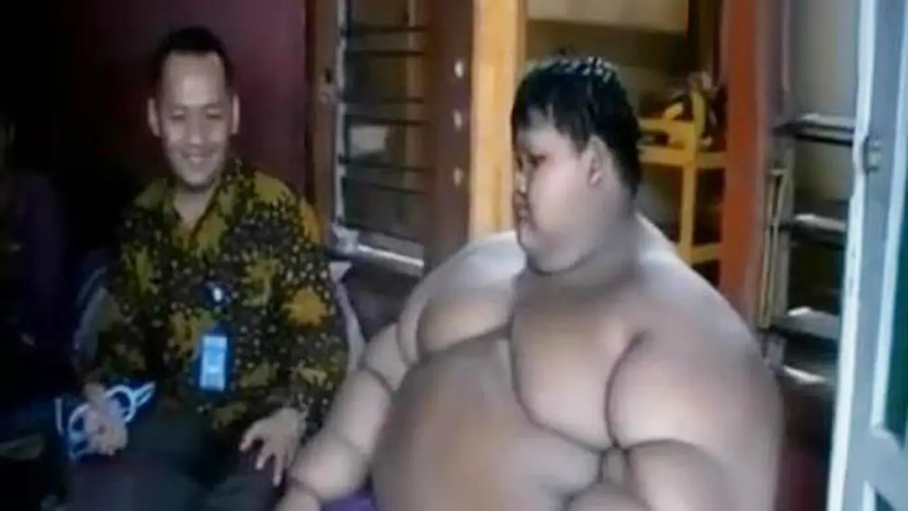 Segmen 7: Bocah Obesitas 140 Kilogram hingga Video Blog Kaesang
