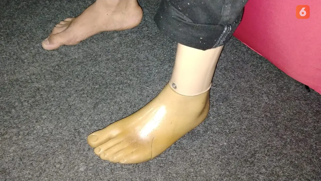 Kaki Palsu Saldi Kito Rato