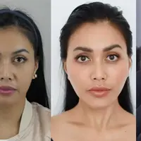 Penyanyi Denada baru saja menjalani operasi facelift atau pengencangan wajah. Ibunda dari Aisha Aurum itu mengaku sejak lama memikirkan untuk menjalani operasi tersebut. Denada mengaku sempat menangis jelang menjalani operasi. [Instagram/denadaindonesia/Youtube/ Maia ALELDUL]