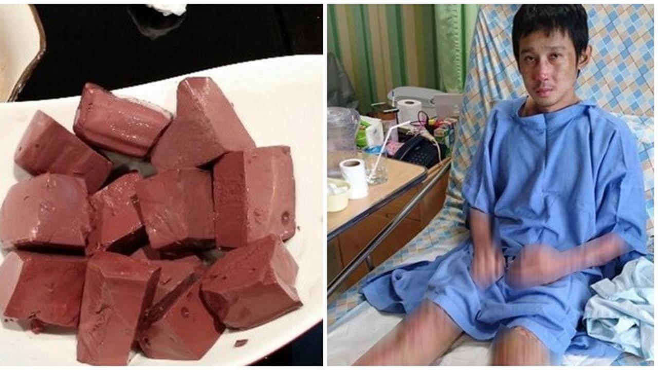 Konsumsi Darah Babi, Nasib Pria Ini Sungguh Tragis