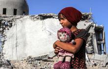 Pilunya Gadis Cilik Gaza Punya Luka Berat di Wajah Usai Serangan Israel, Didatangi Psikolog Sosoknya Ramai Disorot
