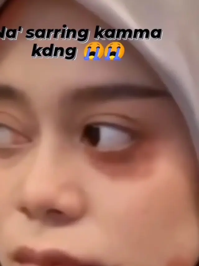 Hoax foto Lesti Kejora lebam (Foto: Story Instagram @aty_ratu_kodong)