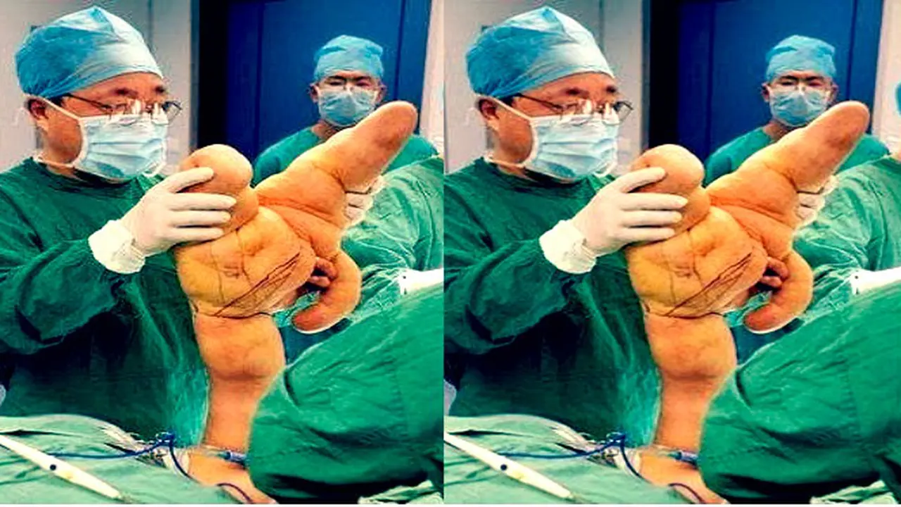 6 Orang Ini Mengidap Kelainan Tubuh Sangat Aneh