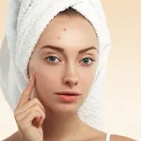 ilustrasi skincare untuk jerawat/pexels