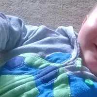 Karena penyakit yang dideritanya sedari lahir, balita ini miliki hidung layaknya Pinokio.