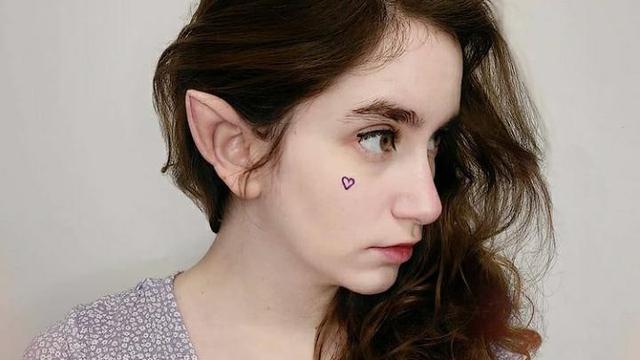 Telinga Peri, Tren Operasi Plastik yang Kembali Digemari Anak Muda di China