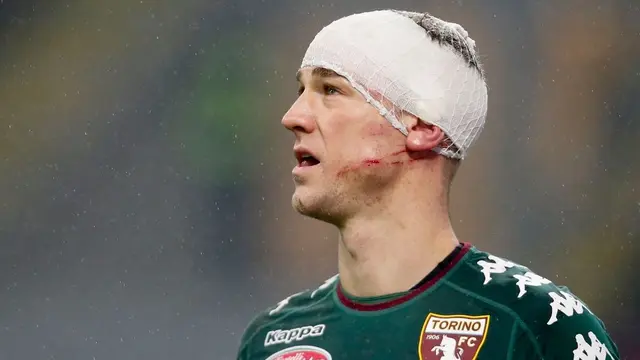 Joe Hart