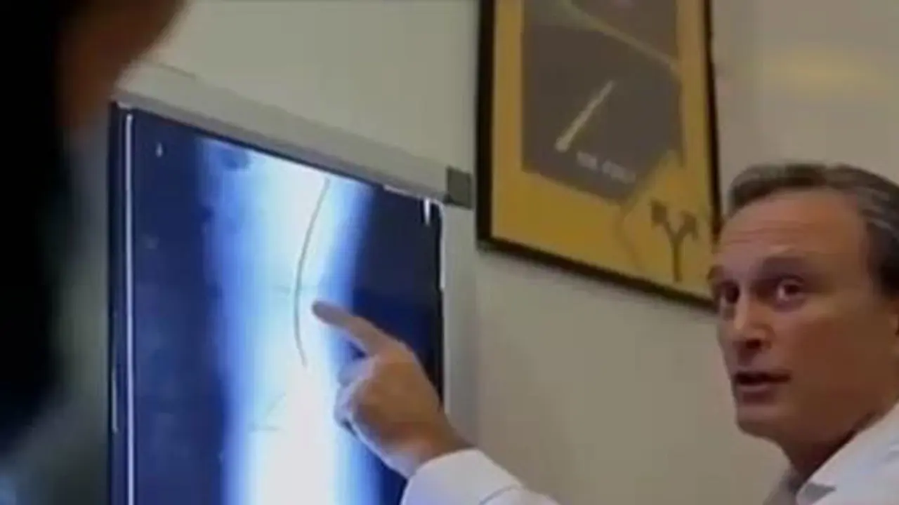 VIDEO: Apa Itu Terapi Chiropractic?