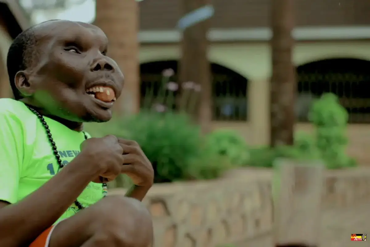 Kisah Cinta Godfrey Baguma, 'The Ugliest Man' di Uganda