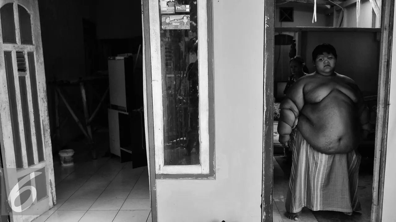 20160630-Obesitas-Ariya-Permana-GMS