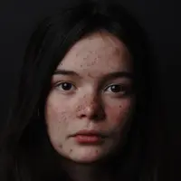 Ilustrasi kulit wajah. Sumber foto: unsplash.com.