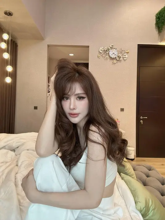 Prosedur yang ia lakukan cukup drastis. Meski sebelumnya sudah cantik, kini banyak yang memuji dirinya lebih cantik. [Instagram.com/emilyyoungryu]