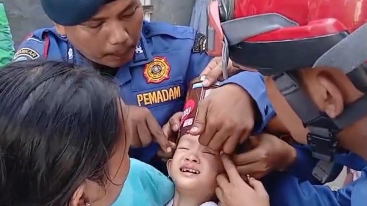 Petugas Damkar Lepaskan Kaleng Biskuit dari Kepala Balita