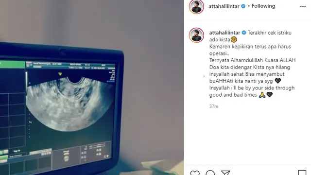 Atta Halilintar - Aurel Hermansyah (Foto: Instagram/@attahalilintar)