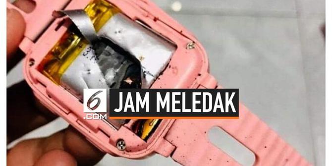 VIDEO: Waspada Jam Tangan KW Meledak, Anak Ini Jadi Korbannya