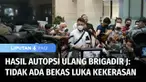 Perhimpunan Dokter Forensik Indonesia atau PDFI menyerahkan hasil autopsi ulang jenazah Brigadir Yosua ke Bareskrim Polri. Dari sejumlah poin yang didapat, PDFI memastikan tidak ada organ tubuh yang hilang, kematian korban disebabkan lima luka tembak...