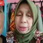 Sering Disangka Nenek-nenek, Wanita 28 Tahun Ini Idap Penyakit Langka (Sumber: TikTok/@puspaa126)