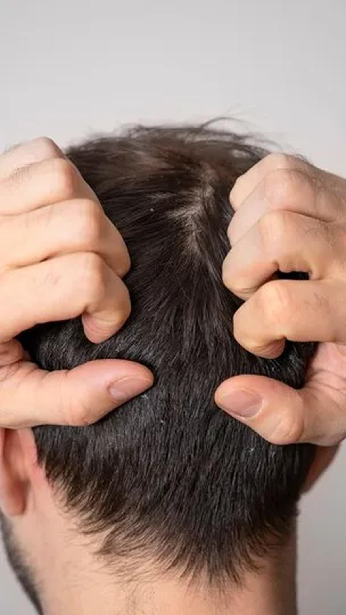Penggunaan Produk Perawatan Rambut: Efek Keramas dan Perawatan Rambut Lainnya