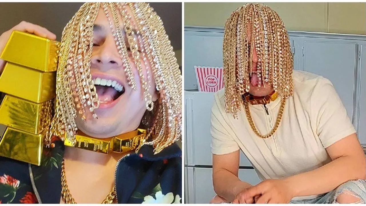 Rapper Ini Pasang Implan Rantai Emas di Kepala Jadi Pengganti Rambut, Curi Perhatian
