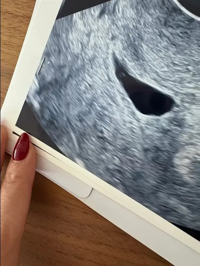 Nikita Willy keguguran (Instagram/nikitawillyofficial94)