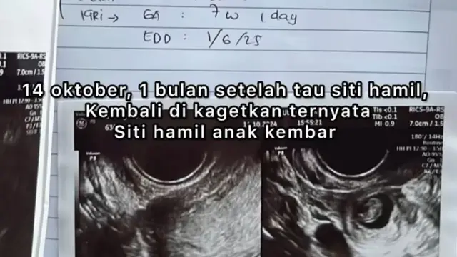 Kronologi Siti Badriah Kehilangan Satu Janin Kembar (credit: https://www.instagram.com/krisjianabah/)