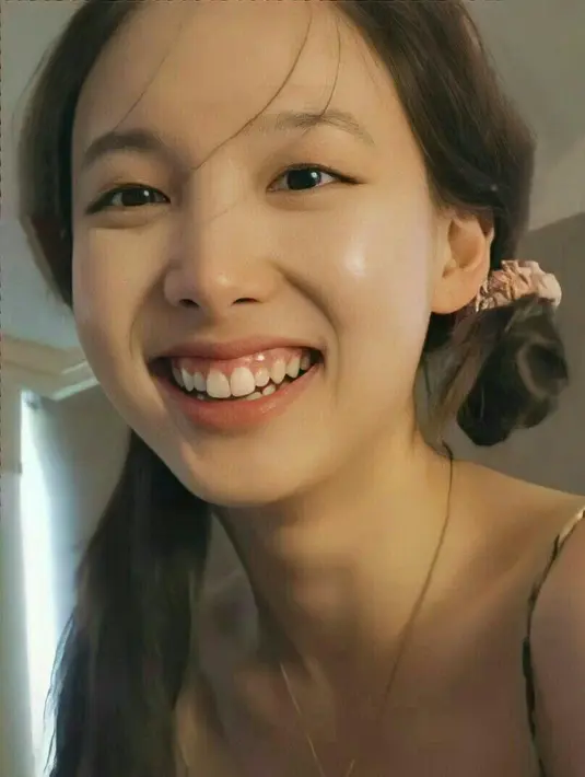 Tentu Nayeon punya alasan tersendiri untuk tak lagi punya bunny teeth. Fans ikut mendukung keputusan itu demi kenyamanan dan kepercayaan diri sang idola. [Pinterest]