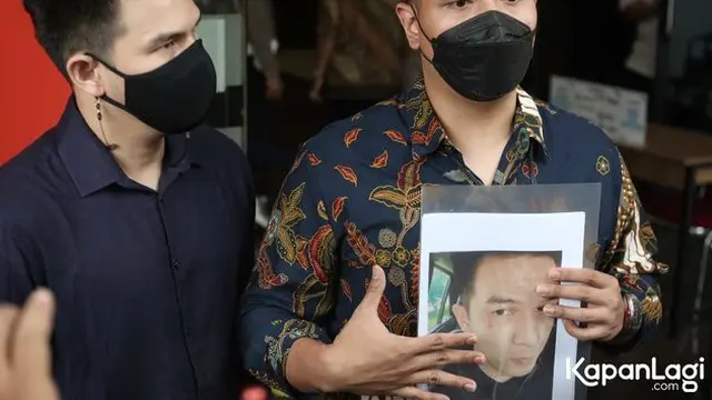 Ditendang hingga Dipukul Barbel, Ini 6 Potret Bukti Jonathan Frizzy Diduga Alami KDRT