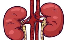 Penting Dipahami! Ini Gejala Batu Ginjal, Cara Mendeteksi, dan Kapan Harus ke Dokter