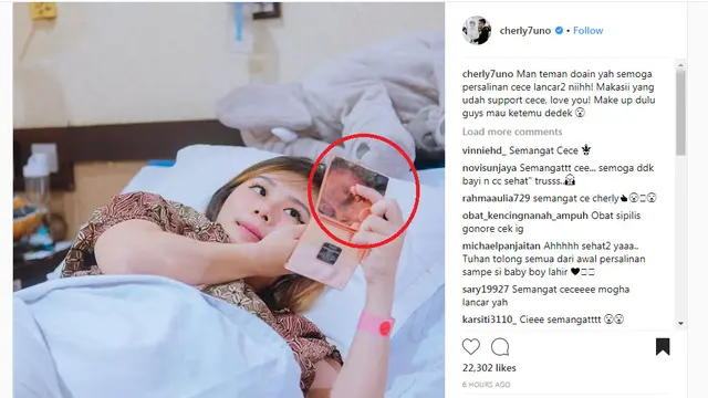 Cherly eks Cherrybelle
