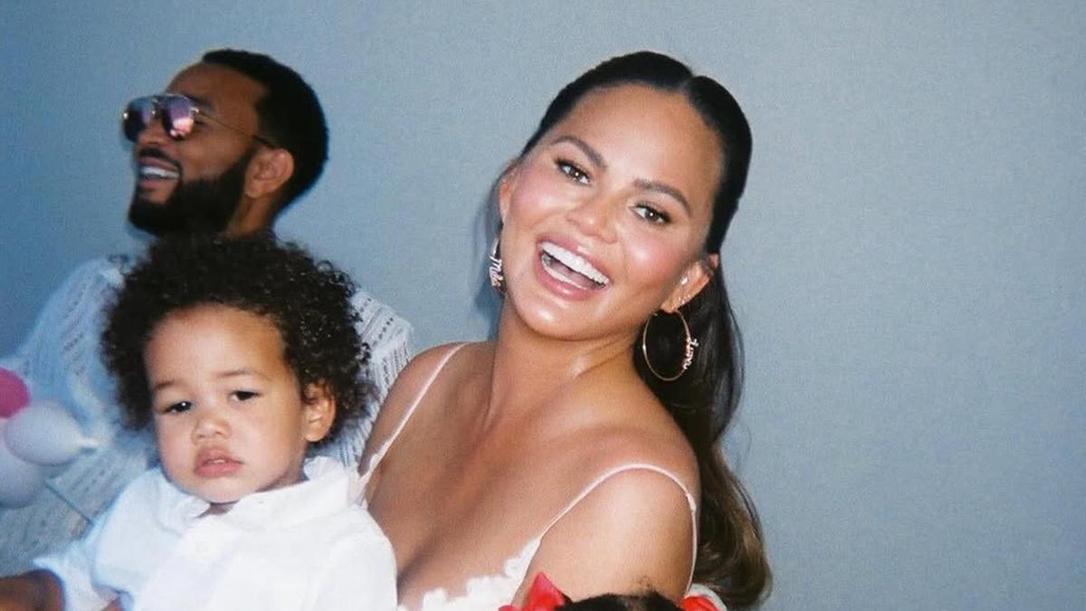 Chrissy Teigen Jalani Operasi Hairline Lowering Akibat Rambut Rontok Pasca Melahirkan, Ini Penjelasan dan Biaya Prosedurnya