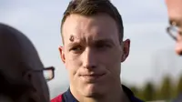 Phil Jones Cedera, Inggris Makin Menderita
