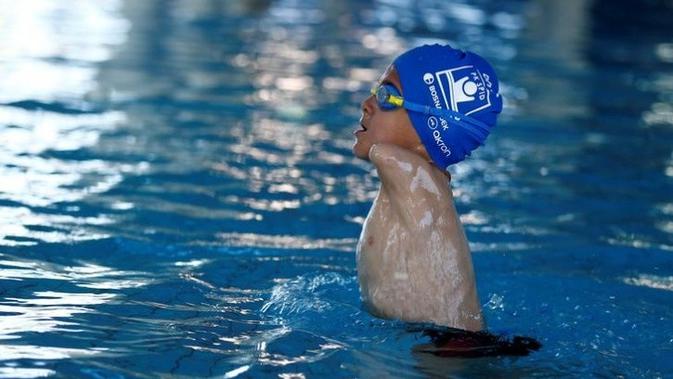 Inspiratif Bocah Tanpa Lengan Raih Medali Emas Di Lomba Renang Citizen6 Liputan6 Com