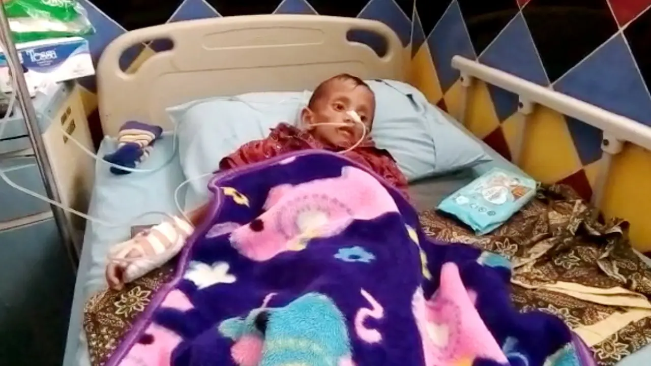 Balita Afri (4,5) dirawat di RS Goeteng Taroenadibrata, Purbalingga lantaran gangguan penecernaan yang berakibat kekurangan gizi. (Foto: Liputan6.com/Dinkominfo Purbalingga/Muhamad Ridlo)