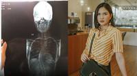 Akui Tak Malu Idap Skoliosis, Ini 6 Potret Jessica Mila saat Olahraga (sumber: Instagram.com/jscmila)