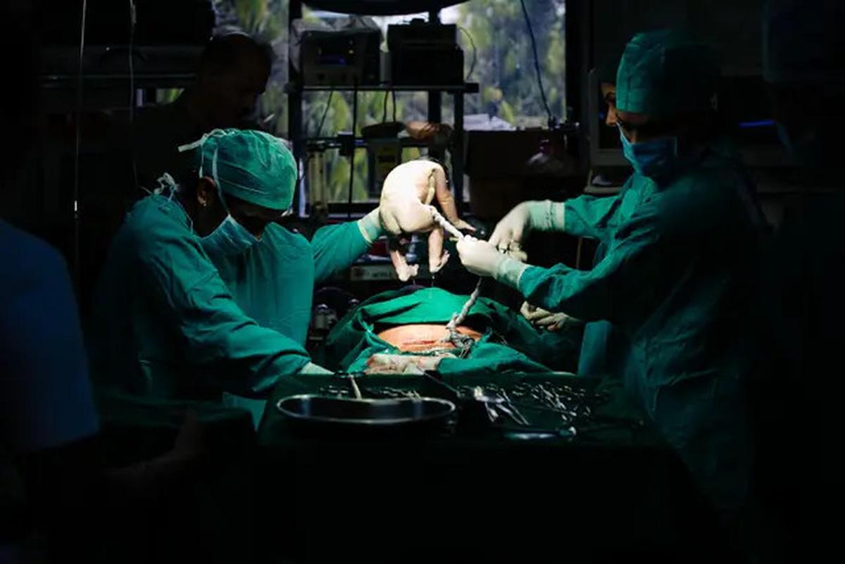 Mengeluh Sakit Perut selama 18 Tahun, Ternyata Ada Jarum di Vagina Wanita Ini