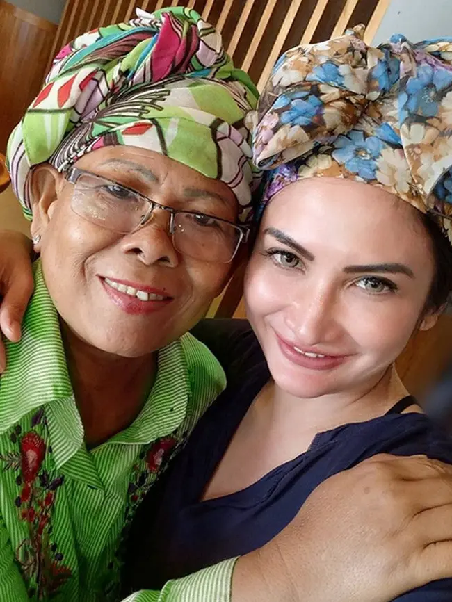 Saat mengunggah foto ini, Natalie menuliskan bahwa sang ibu akan menjalani operasi pemasangan pot dan melakukan kemoterapi yang ke empat. Namun dalam foto senyum semringah hadir di keduanya. (Instagram/natalie_sarahs)