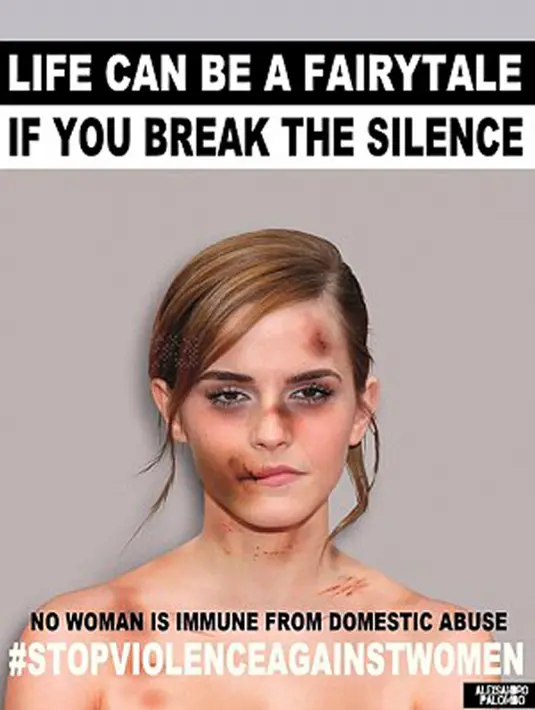 Aktris Emma Watson ditampilkan dengan wajah lebam seperti habis dipukul. Foto yang diedit itu pun diberi tulisan yang memotivasi wanita untuk melawan tindak kekerasan. (dailymail.co.uk)