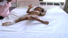  Asti balita berusia lima tahun ini, terus  menangis saat dibawa ke rumah sakit daerah polewali mandar. kondisi badannya yang semakin kurus dan sakit-sakitan.