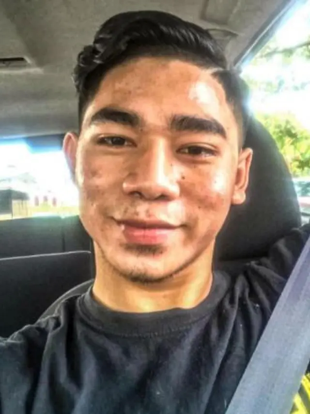 Dulu Dibully Wajah Seperti Jalanan Rusak, Perubahan Pria Ini Bikin Kagum