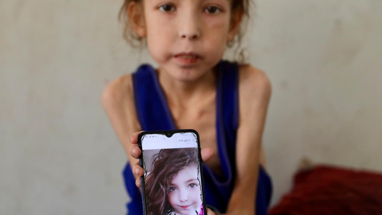 Gadis Kecil di Gaza: 'Saya Dulu Suka Bercermin dan Swafoto, Tapi Sekarang Saya Benci Melihat Diri Sendiri. Ini Bukan Saya