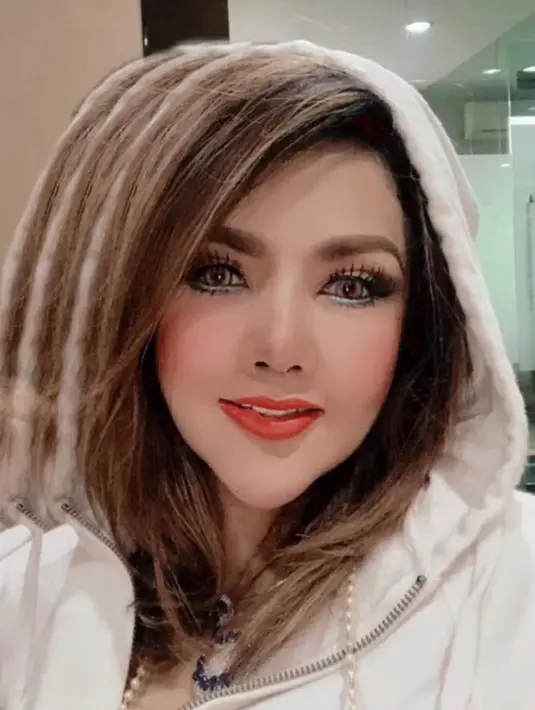 Sebelumnya, Barbie Kumalasari sudah tiga kali melakukan kuret hidung karena infeksi filler. Setelah itu, dirinya mengaku dua kali menjalani operasi hidung. Total sudah ada enam kali ia merombak bagian hidungnya.  (Instagram/barbiekumalasari).