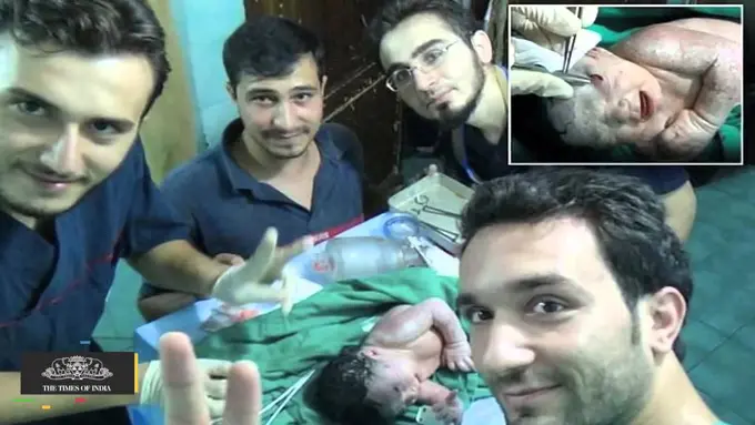 Bayi Suriah Ini Lahir dengan Pecahan Peluru Menancap di Dahi