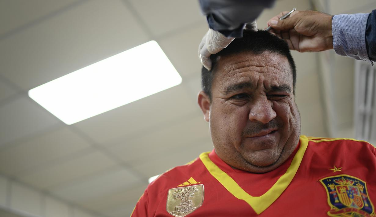 Seorang dokter melakukan terapi akupunktur pada pasien terpapar virus Corona COVID-19 yang baru pulih di pusat kesehatan yang dikelola pemerintah di lingkungan Coche di Caracas, Venezuela pada 25 Februari 2021. (AP Photo / Matias Delacroix)