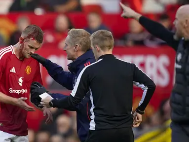 Pemain Manchester United, Matthijs de Ligt mendapatkan perawatan saat kepalanya mengalami pendarahan dalam laga lanjutan Liga Inggris 2024/2025 melawan Brentford di Old Trafford, Manchester, Sabtu (19/10/2024). (AP Photo/Dave Thompson)