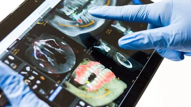 Lakukan 32 Prosedur Berlebihan dalam Satu Sesi, Wanita Ini Tuntut Dokter Giginya